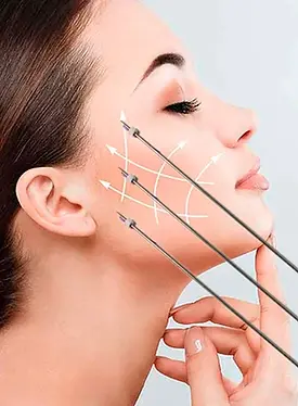 Imagen de Hilos Tensores